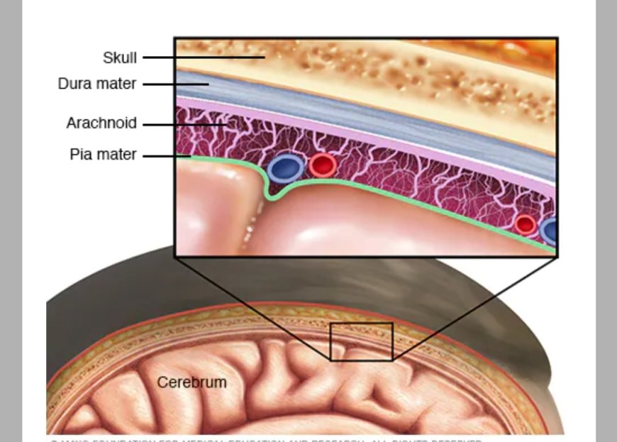 Meningitis- Overview